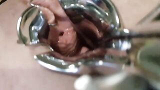 Lola Larouge: Kletsnatte kutje met speculum en vingers